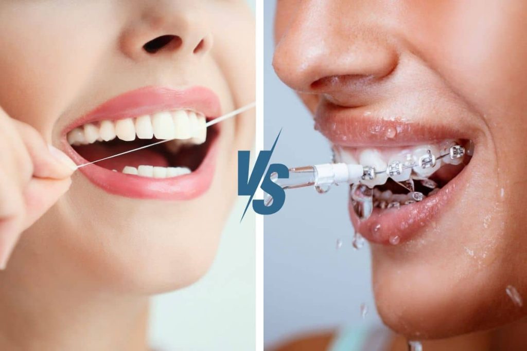 water flossing vs traditional flossing