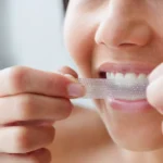 teeth whitening whats safe and whats not