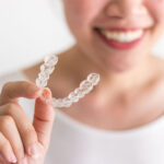 guide to invisalign