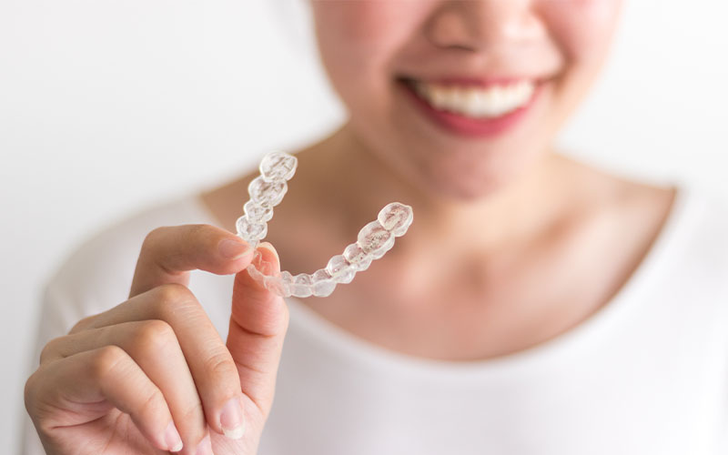 guide to invisalign