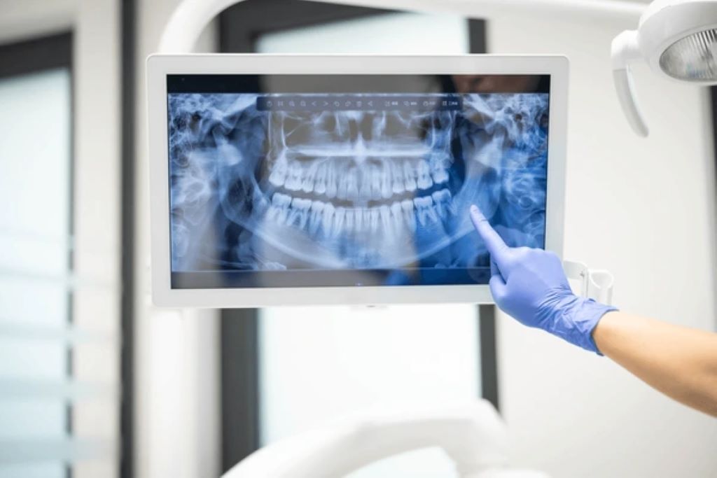 dental x-rays in downtown calgary ab