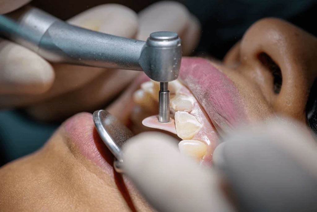 restorative dentistry in downtown calgary ab