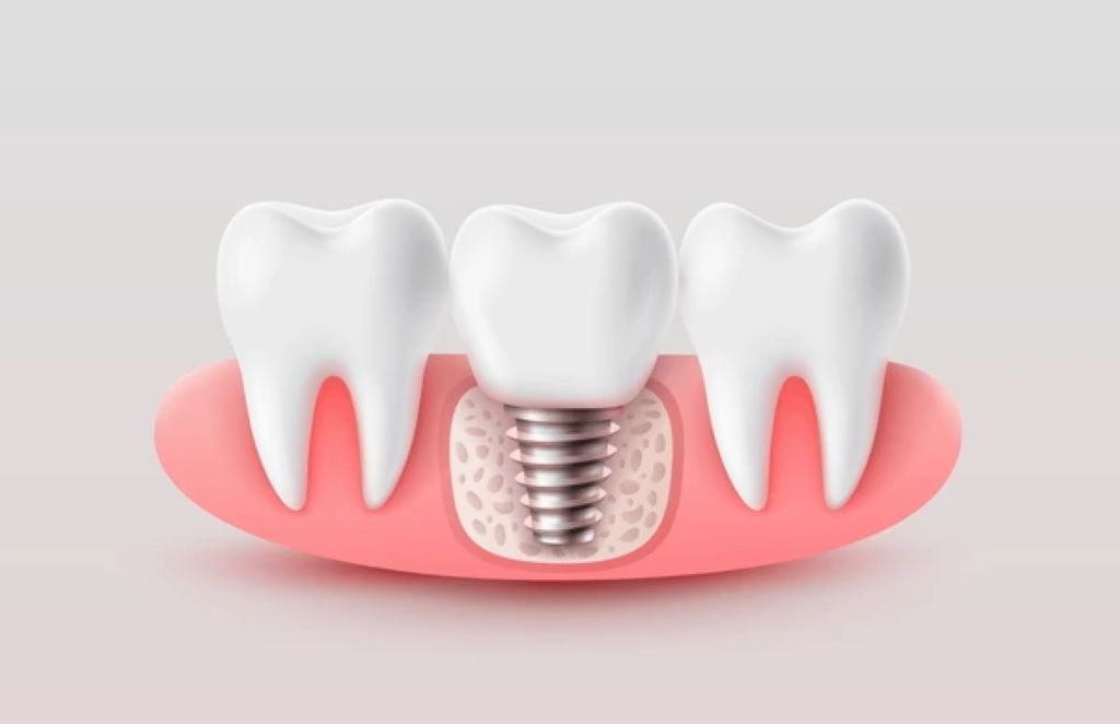 restorative dentistry near you