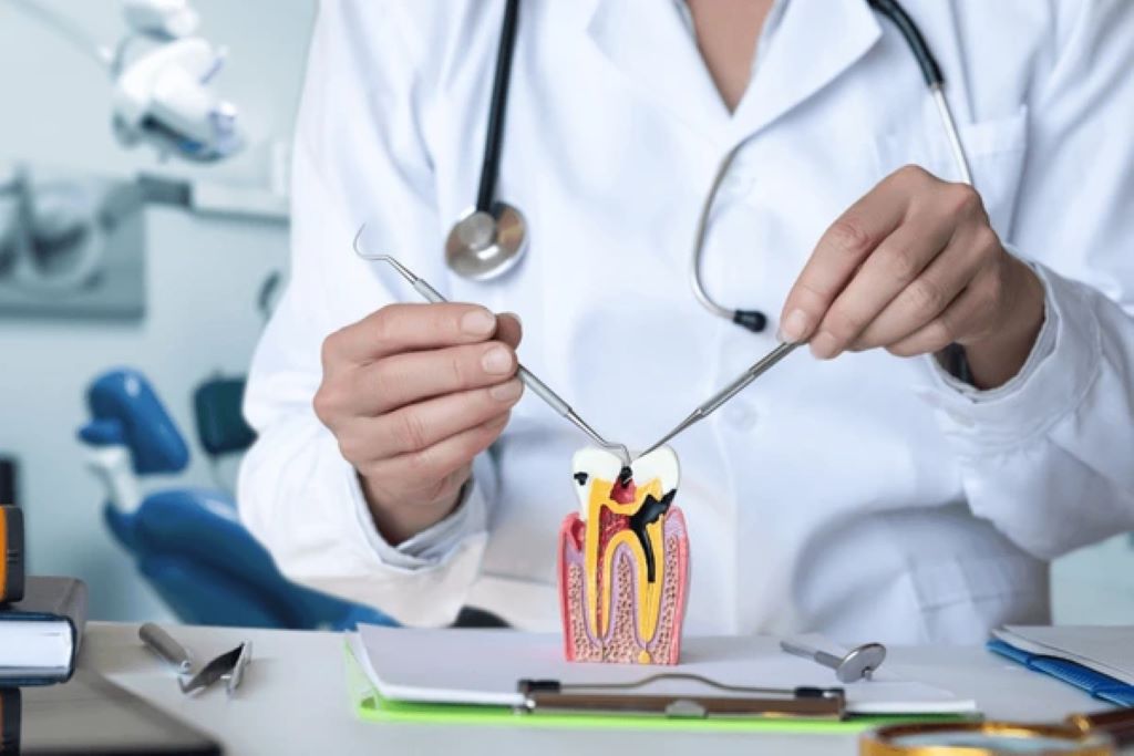 root canal therapy near you