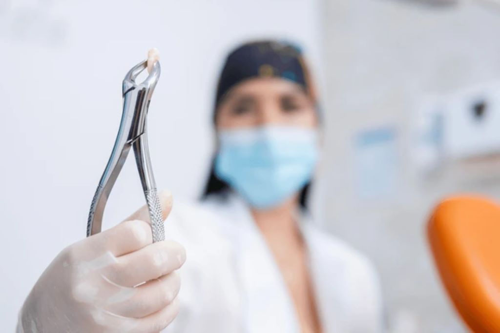 tooth extractions near you
