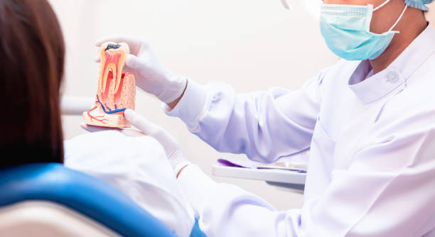 what happens during a root canal procedure step by step guide